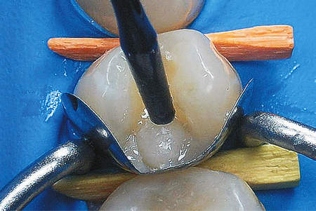 Kliny drewniane - jeden kolor (op. 100 szt.) niebieskie - średnie, krótkie (1.185) - TOR VM