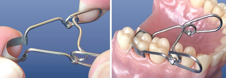 Saddle Contoured Metal Matrices. Universal Kit for Premolars 0,035 mm (36 pcs/box) - TOR VM