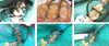 Sectional contoured metal matrices (50 pcs box) large 0.050mm soft - TOR VM