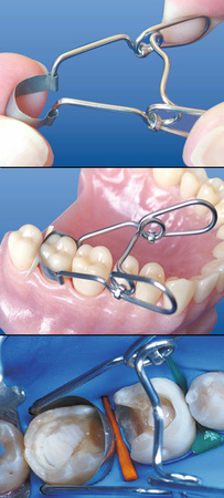 Saddle Contoured Metal Matrices. Universal Kit for Premolars 0,035 mm (36 pcs/box) - TOR VM